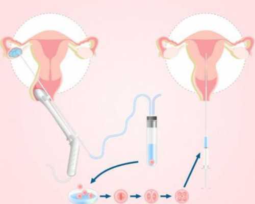 武汉代怀机构优势,武汉供卵试管多少钱？捐供卵试管医院推荐排名！