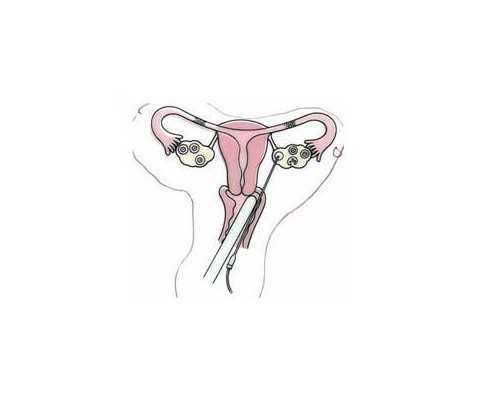 武汉供卵在哪里,重庆上海广州武汉成都试管,重庆是武汉的吗