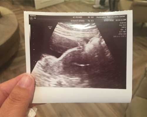 武汉温州医院能供卵吗,武汉正规供卵试管医院,武汉正规供卵机构