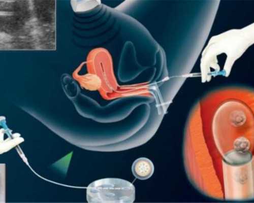 子宫肌瘤现在5.6cm如果不处理带瘤怀孕会有什么影响吗？