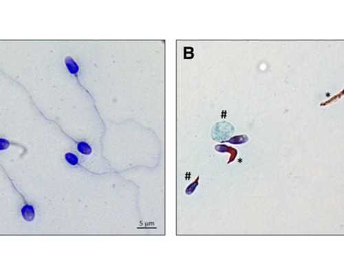 胎停育是染色体问题吗,助孕胎停育你检查过染色体问题吗？~代怀宝宝