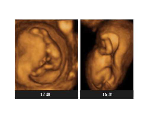 试管胚胎透明带厚的原因？透明带厚试管能不能成功？~供卵代怀咨询