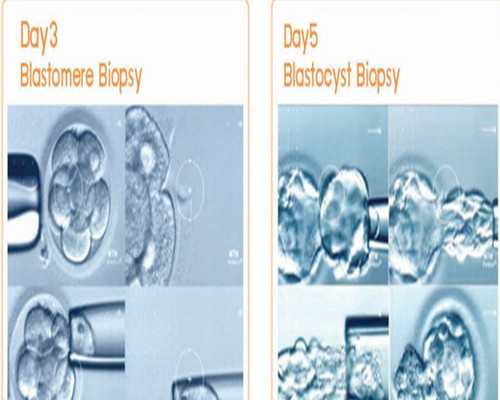 试管婴儿移植后症状都有什么？