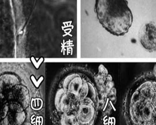 鲜胚移植后第八天胃疼胃胀浑身冒冷汗怎么办?~助孕机构招聘官网