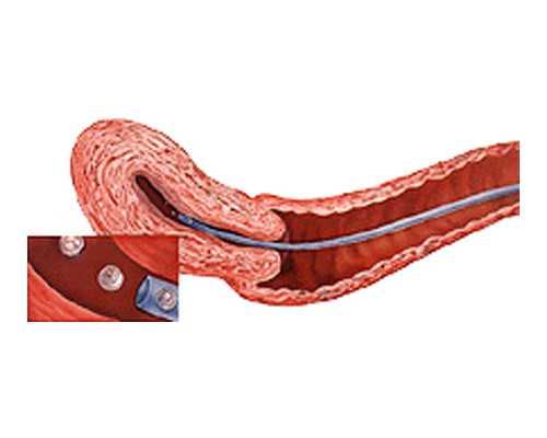 武汉供卵公司咨询,武汉供卵春晖,武汉供卵试管