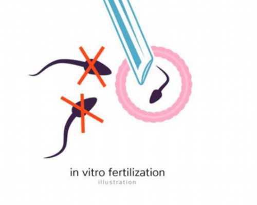 武汉哪能做试管代怀,武汉艾德华兹程丹谈试管婴儿空卵泡