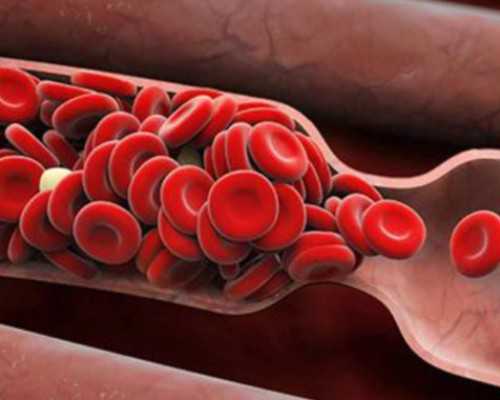 精子畸形率高做试管一代还是二代~靠谱捐卵