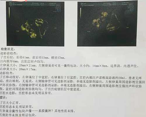 武汉供卵好做吗,武汉供卵三代生子,武汉供卵借腹生子