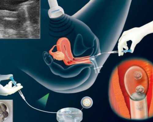 武汉找人代生宝宝,武汉包生儿子,武汉三代试管包男孩机构一览!