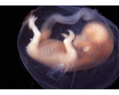 鲜胚移植不成功的征兆，胚胎移植不成功的征兆~助孕公司咨询