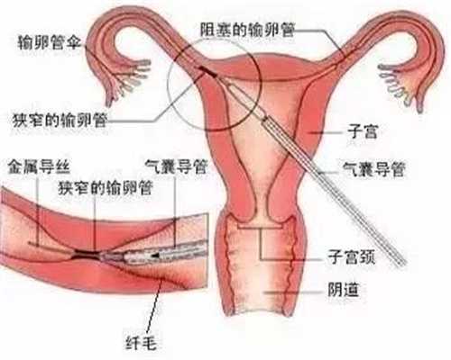 武汉和睦家代孕中心：找武汉可靠代孕中介：月子餐第一周 ，如何安排？