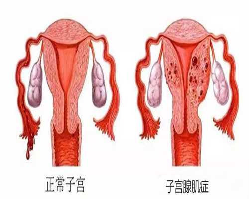 武汉代孕的龙凤胎：武汉代孕生殖中心有做过吗：1626516229160
